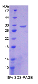 烟碱型胆碱受体β2(CHRNβ2)重组蛋白