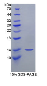 微纤丝关联蛋白5(MFAP5)重组蛋白