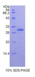 核因子κB抑制因子ε(IκBε)重组蛋白