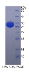 整合素α2E(ITGα2E)重组蛋白