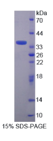 含三核苷酸重复序列蛋白6A(TNRC6A)重组蛋白
