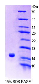 受体相互作用丝氨酸苏氨酸激酶2(RIPK2)重组蛋白