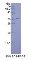卷曲同源物10(FZD10)重组蛋白