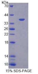 氧化应激诱导生长抑制因子1(OSGIN1)重组蛋白