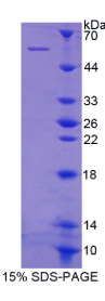 整合素β1(ITGβ1)重组蛋白