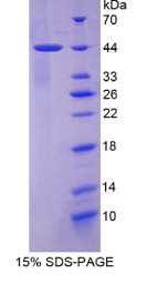 角蛋白7(KRT7)重组蛋白