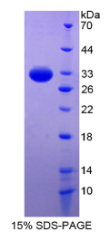 核因子κB抑制因子β(IκBβ)重组蛋白