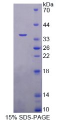 甲基CpG结合域蛋白2(MBD2)重组蛋白