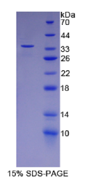 卵泡抑素样蛋白1(FSTL1)重组蛋白