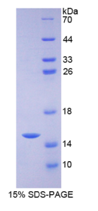 溶质载体家族30成员5(SLC30A5)重组蛋白