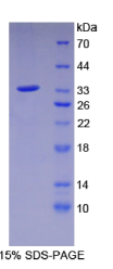 含C2钙依赖型域蛋白3(C2CD3)重组蛋白