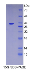 检查点蛋白同源物2(CHEK2)重组蛋白