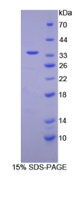 视黄醇结合蛋白3(RBP3)重组蛋白