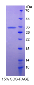 膜联蛋白A6(ANXA6)重组蛋白