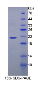 含溴区蛋白8(BRD8)重组蛋白