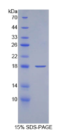 角蛋白19(KRT19)重组蛋白