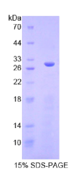 血清/糖皮质激素调节激酶3(SGK3)重组蛋白