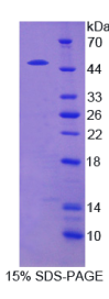 含侧支发芽因子相关EVH1域蛋白2(SPRED2)重组蛋白