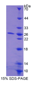 含胶原三螺旋重复蛋白1(CTHRC1)重组蛋白