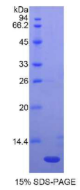 巨噬细胞炎性蛋白1β(MIP1β)重组蛋白