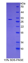 含亮氨酸丰富重复蛋白32(LRRC32)重组蛋白