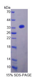 细胞色素b-245β肽(CYBβ)重组蛋白