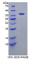 激酶锚定蛋白11(AKAP11)重组蛋白