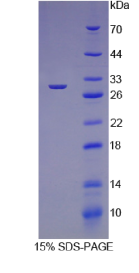 肥大细胞类糜蛋白酶1(CMA1)重组蛋白
