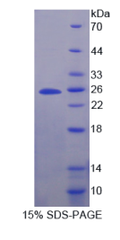 分泌粒蛋白Ⅴ(SCG5)重组蛋白
