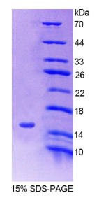 溶质载体家族30成员3(SLC30A3)重组蛋白