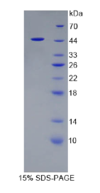 核糖核酸酶A(RNASE1)重组蛋白