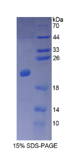 钙调蛋白样蛋白3(CALML3)重组蛋白