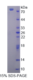 含溴区蛋白1(BRD1)重组蛋白