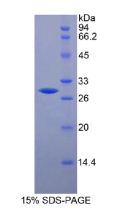 软骨糖蛋白39(GP39)重组蛋白