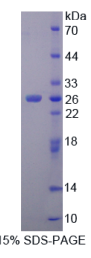 细胞因子信号转导抑制因子2(SOCS2)重组蛋白