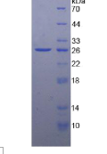 纤维胶凝蛋白1(FCN1)重组蛋白