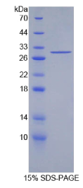 胰岛素受体底物1(IRS1)重组蛋白