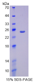 过氧化物酶体增殖物激活受体γ辅激活因子1α(PPARγC1α)重组蛋白