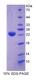 应激诱导磷蛋白1(STIP1)重组蛋白