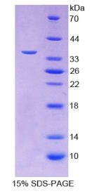 卵泡抑素样蛋白1(FSTL1)重组蛋白