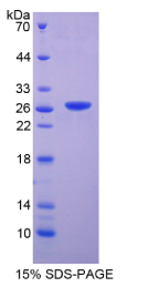 脱氧核糖核酸酶Ⅰ样2(DNASE1L2)重组蛋白