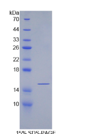 分泌型卷曲相关蛋白5(SFRP5)重组蛋白