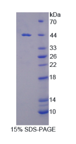 分拣连接蛋白9(SNX9)重组蛋白