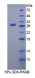 含硬化蛋白域蛋白1(SOSTDC1)重组蛋白