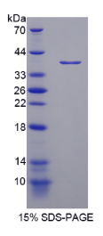 核受体共激活因子3(NCOA3)重组蛋白