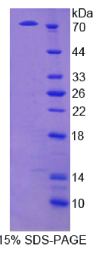 细胞外基质蛋白1(ECM1)重组蛋白