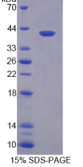慢型肌球蛋白结合蛋白C(MYBPC1)重组蛋白
