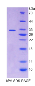 胃动蛋白2(GKN2)重组蛋白