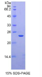 巨噬细胞炎性蛋白1β(MIP1β)重组蛋白