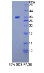 肝胶原凝集素1(CLL1)重组蛋白